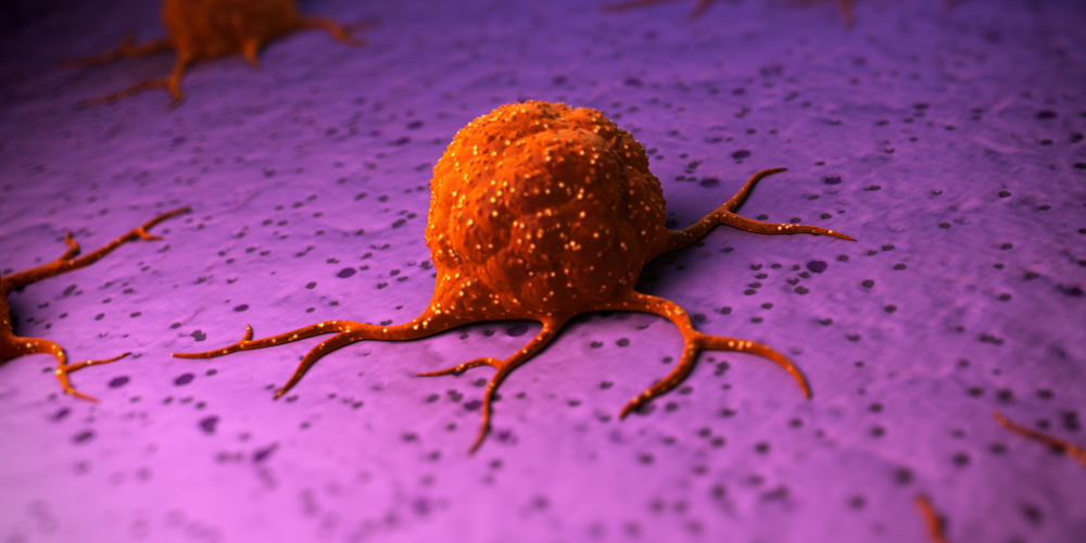 3D-Abbildung einer Krebszelle